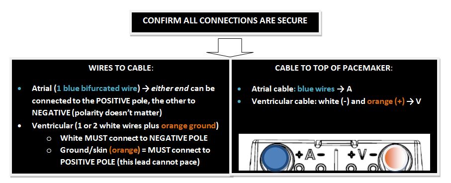 Protocol: Temporary Pacemaker Verification and Troubleshooting
